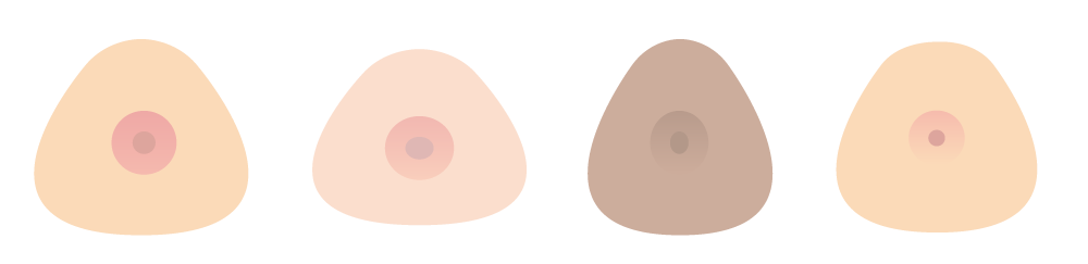 prothèse externe mammaire